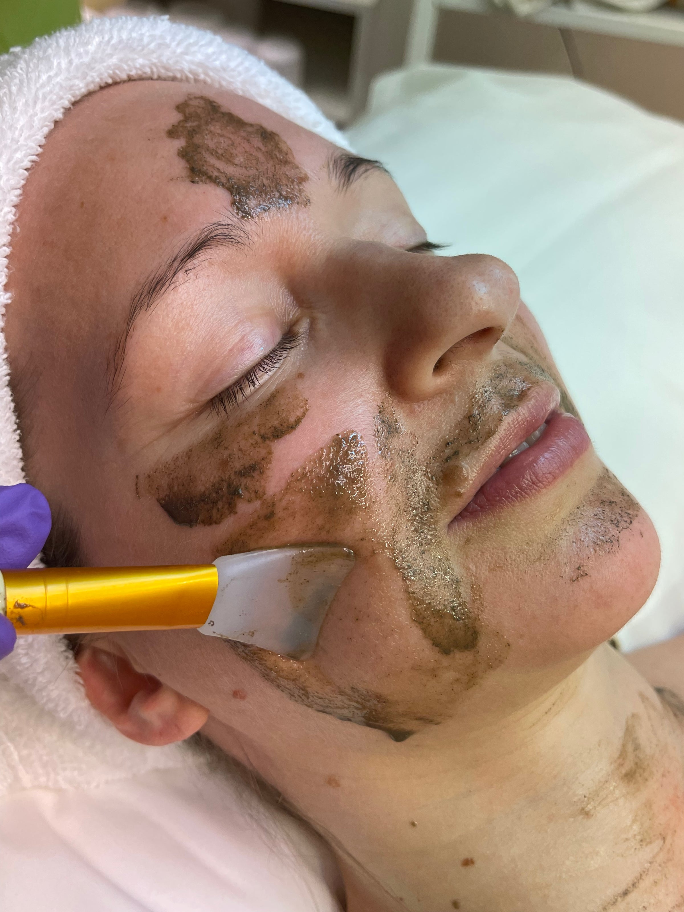 a baikal facial treatment